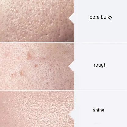 Kit com 3 Séruns para Cuidados Faciais: Hidratação, Hidratação e Peeling Químico, 400ml (AS1, SA2, AO3) para Limpeza Profunda da Pele com Aparelho Facial