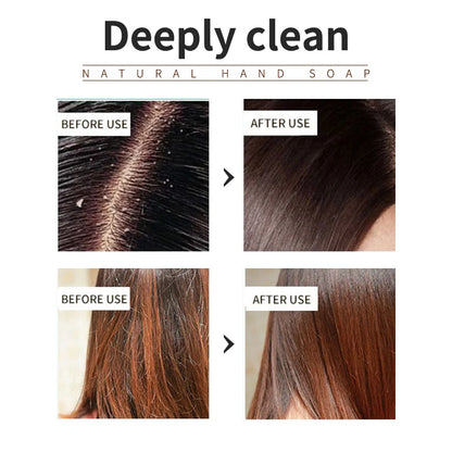 O champô vegetal com óleo essencial de árvore do chá é refrescante, controla a oleosidade, reduz a caspa e fortalece o cabelo