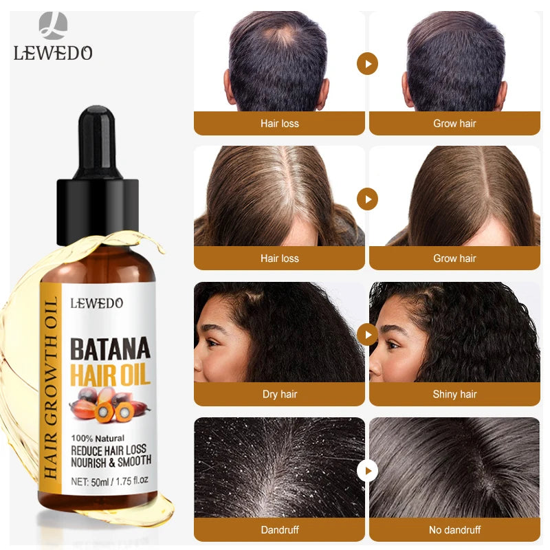 Sérum de Óleo de Batana para Crescimento Capilar: Óleo Essencial para Cabelo em Crescimento Rápido, Beleza e Cuidado Capilar, Essência Antiqueda, Reparação Natural de Cabelo Danificado.