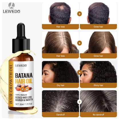 Sérum de Óleo de Batana para Crescimento Capilar: Óleo Essencial para Cabelo em Crescimento Rápido, Beleza e Cuidado Capilar, Essência Antiqueda, Reparação Natural de Cabelo Danificado.