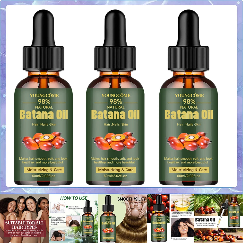 Óleo de batata natural para crescimento do cabelo, óleo de batata puro para fortalecer o brilho do cabelo para mulheres, prevenir a perda de cabelo, eliminar pontas duplas, 1/3 peças✨