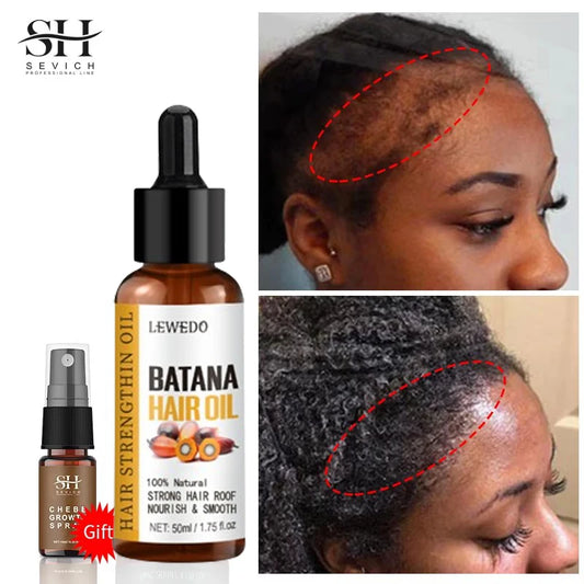 Sérum de Óleo de Batana para Crescimento Capilar: Óleo Essencial para Cabelo em Crescimento Rápido, Beleza e Cuidado Capilar, Essência Antiqueda, Reparação Natural de Cabelo Danificado.