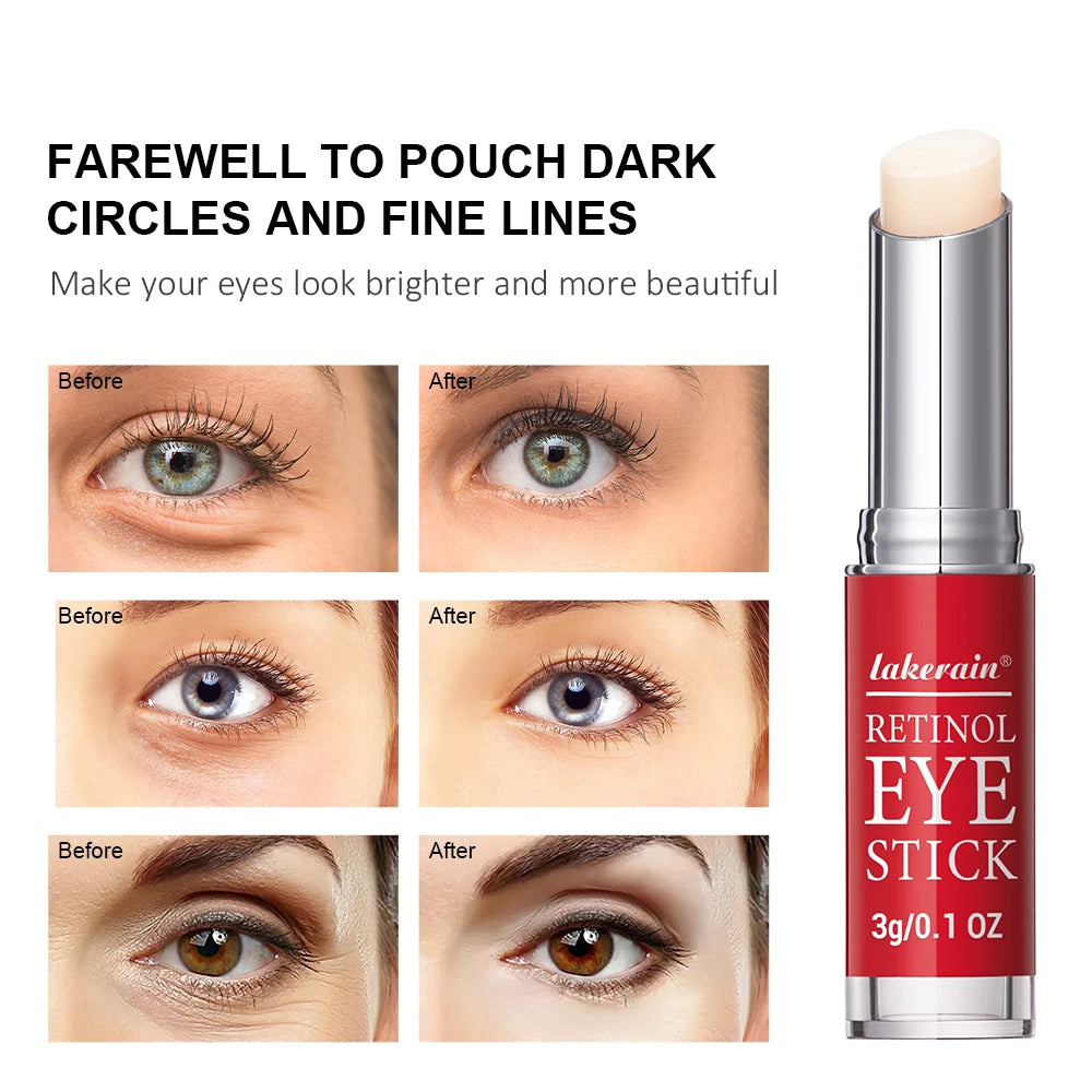 Retinol creme para os olhos clareamento círculos escuros endurecimento da pele reparação instantânea soro vara para mulheres cuidados com os olhos ✨👁️