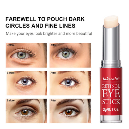 Retinol creme para os olhos clareamento círculos escuros endurecimento da pele reparação instantânea soro vara para mulheres cuidados com os olhos ✨👁️