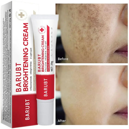 Creme Facial Uniformizador para Manchas e Pigmentação da Pele.