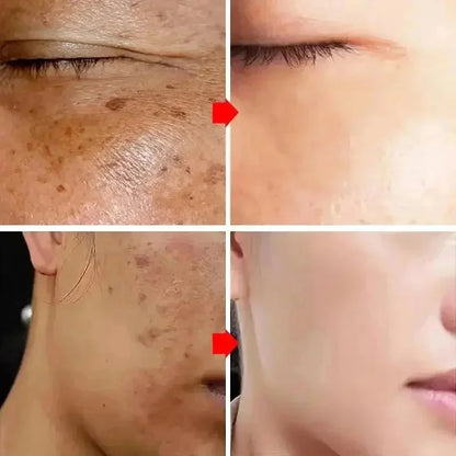Creme Facial Coreano Uniformizador para Manchas Escuras .