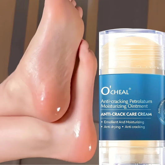 Creme anti-rachaduras para pés e calcanhares secos e rachados, hidratando pés e calcanhares secos, evitando rachaduras nos 👣 pés ✨