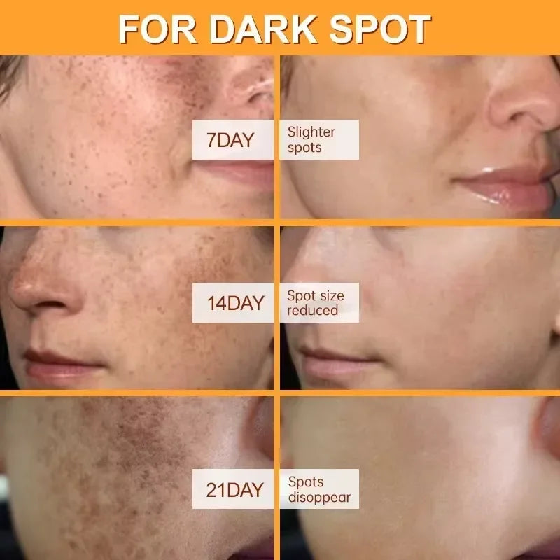 Creme Facial Uniformizador para Manchas e Pigmentação da Pele.