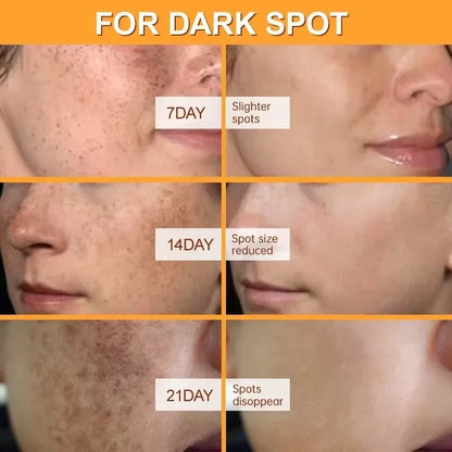 Creme Facial Uniformizador para Manchas e Pigmentação da Pele.