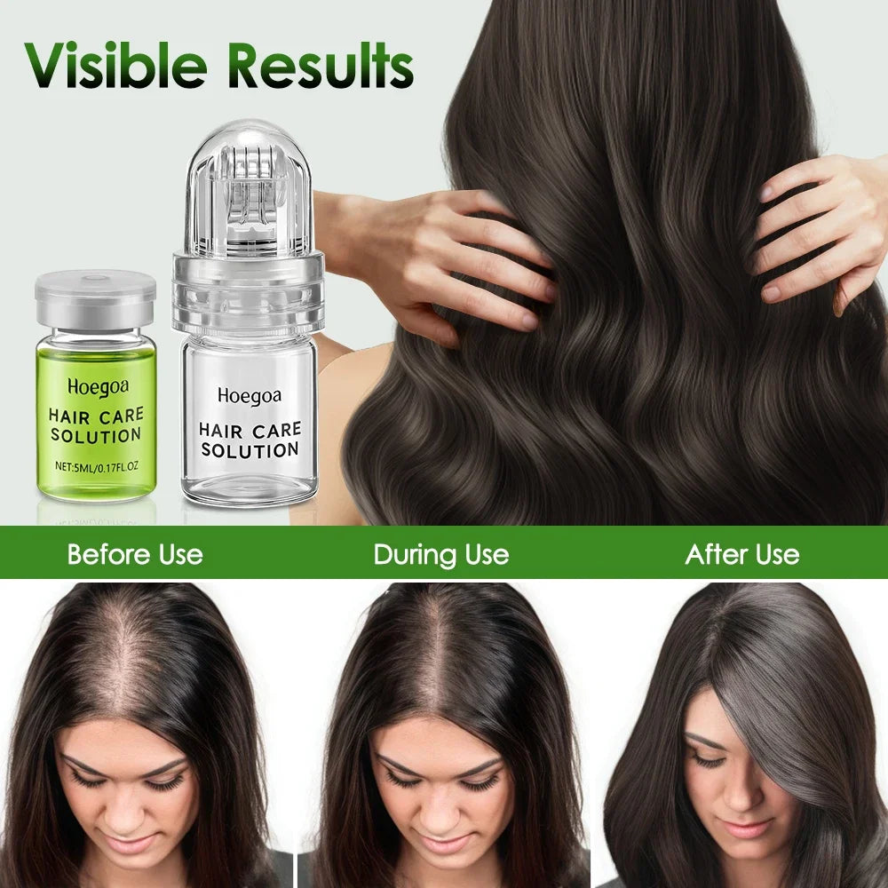 Soro de cuidados essenciais para o cabelo, fortalece as raízes, reduz a perda, evita a calvície, nutre o couro cabeludo, cuidados com o cabelo, condicionador anti-perda de cabelo🍀✨
