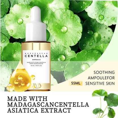 Madagascar Centella Asiatica Serum 55ml - Fórmula calmante para pele sensível com suporte para acne e hidratação profunda para o rosto.✨💎🌿