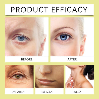 Creme antienvelhecimento com retinol para mulheres, hidratante facial firmador e iluminador, creme noturno de hidratação profunda para pele seca e sensível no inverno