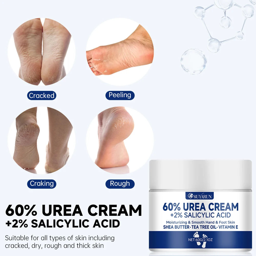 Creme de pés SUYARUN com 60% de ureia para calcanhares gretados e pele seca - Tratamento hidratante intensivo, removedor de calosidades, cuidado para os pés diabéticos.