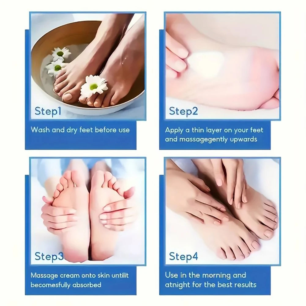 Creme de pés SUYARUN com 60% de ureia para calcanhares gretados e pele seca - Tratamento hidratante intensivo, removedor de calosidades, cuidado para os pés diabéticos.