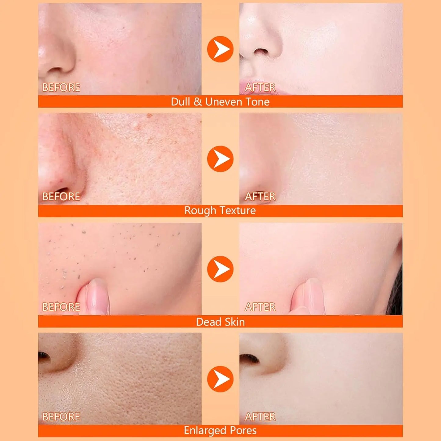 Cuidados com Queratina Corporal Ácido Kójico Cúrcuma Spray Suavemente Esfoliante Peeling Solução Nutritiva Hidratante Cuidados com a Pele Todos os Tipos de Pele
✨