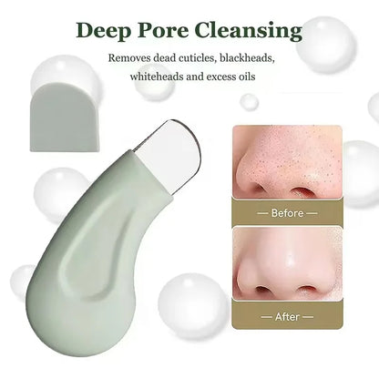 Ferramenta de remoção de cravos e espinhas para nariz e rosto - Ferramentas de limpeza de poros para pele para mulheres✨