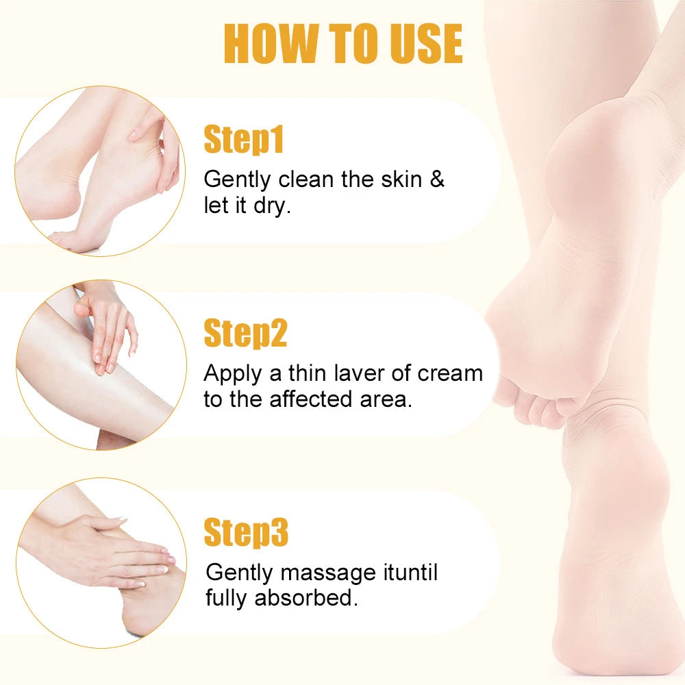 Creme para pés ultra-hidratante 60% ureia 40g Aloe Vera para suavizar pés secos e rachados - esfoliação suave solução diária para cuidados com os pés