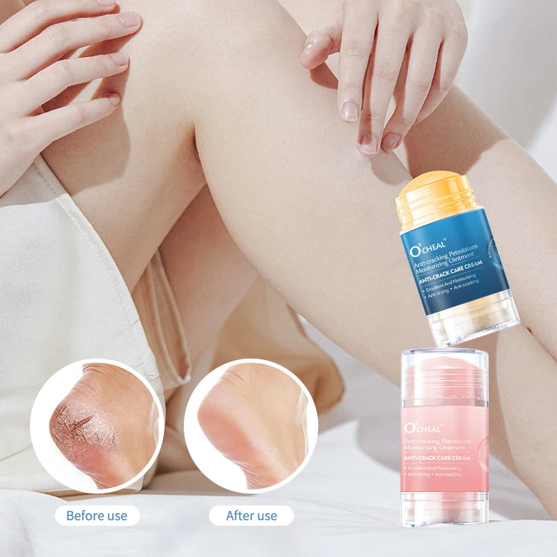 Creme anti-rachaduras para pés e calcanhares secos e rachados, hidratando pés e calcanhares secos, evitando rachaduras nos 👣 pés ✨