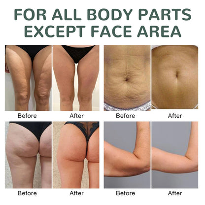Óleo corporal firmador de colágeno, hidratação profunda, hidratante firmador, braço, barriga e excesso de gordura, óleo essencial de massagem para pele de corpo inteiro, 100ml ✨