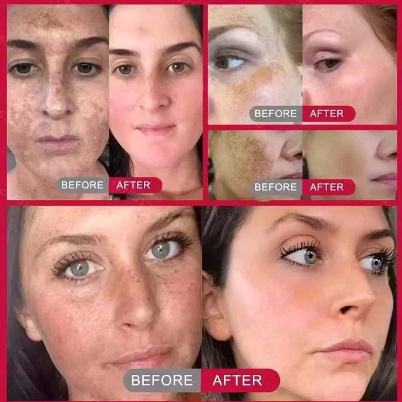 Creme Facial Coreano Uniformizador para Manchas Escuras .